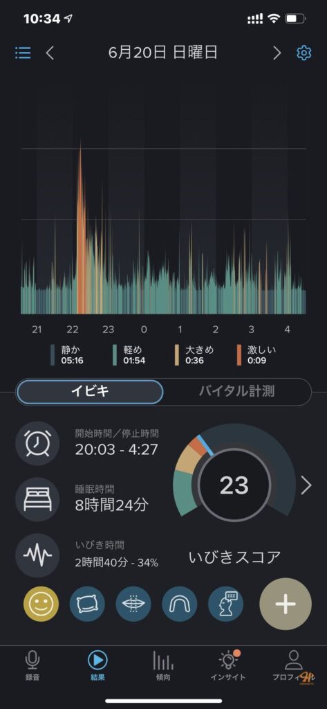 のどちんこ 切る 手術