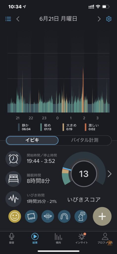 のどちんこ 切る 手術