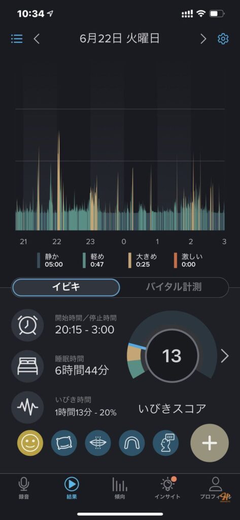のどちんこ 切る 手術