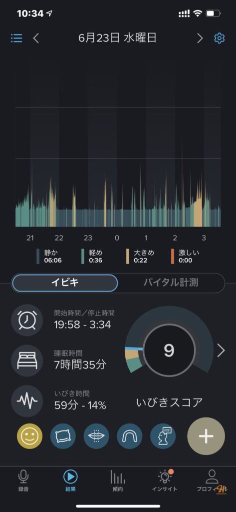 のどちんこ 切る 手術
