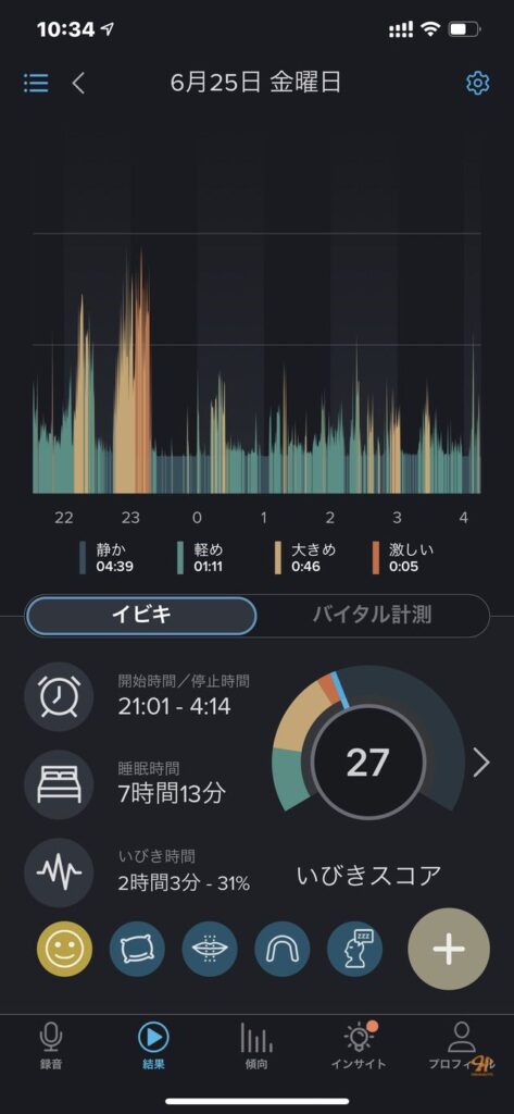 のどちんこ 切る 手術